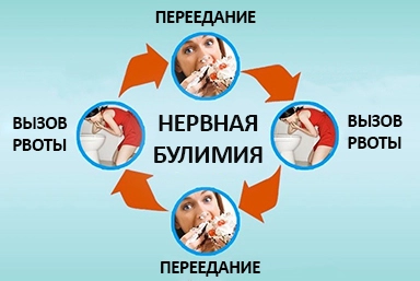 Лечение булимии в Новотитаровской